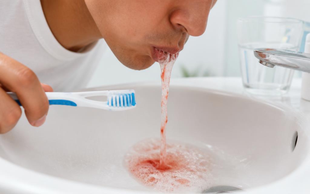 Blood in the sink after brushing, a sign of bleeding gums